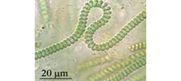Bild von Cyanobacteria